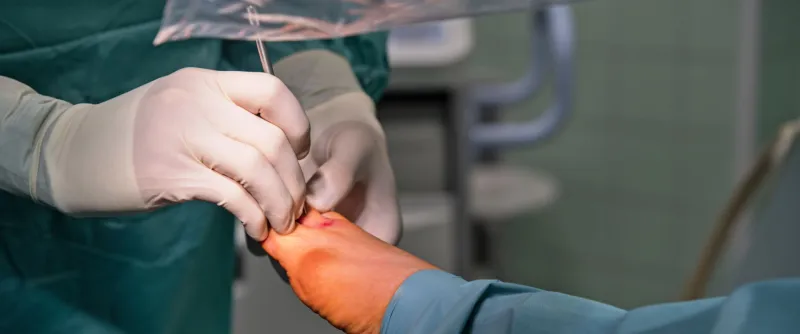 Estetická chirurgie nohy