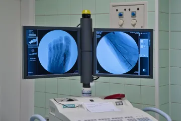 Aesthetic foot surgery