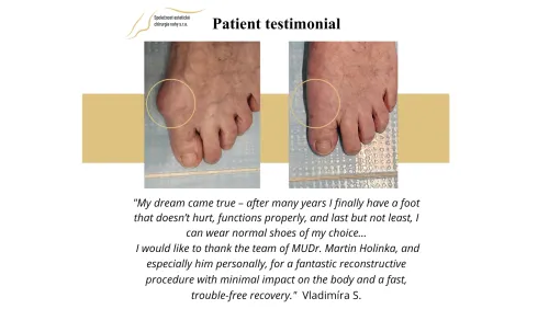 Patient references Aesthetic foot surgery